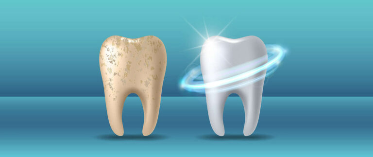 Is Hydroxyapatite Toothpaste The Future of Oral Care?